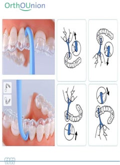 Orthodontic Aligner Chewis and Remover Tool - pzsku/Z0ADCDBE72C40F92956B4Z/45/_/1739607308/50fe76e3-60be-4a59-bdf7-7b97d6771bb6