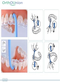 OrthoUnion Orthodontic Aligner Chewis and Remover Tool  - Image 2