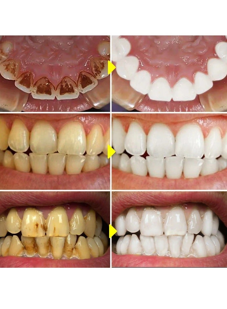 EELHOE Teeth Whitening Beauty Tooth Liquid, Teeth Whitening Bleaching Cleaning Serum, Gentle And Effective Teeth Whitening Liquid Oral Hygiene Removal Essence For White Brightening Teeth - Image 2