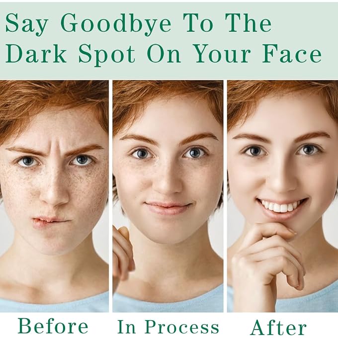 paminify Dark Spot Remover for Face and Body,Dark Spot Corrector with Vitamin C,Nicotinamide,Sun Spot Remover Cream for All Skin Types,Fade Age Spots,Melasma, Freckle, Blemish Reducer,1.7 Oz - Image 3