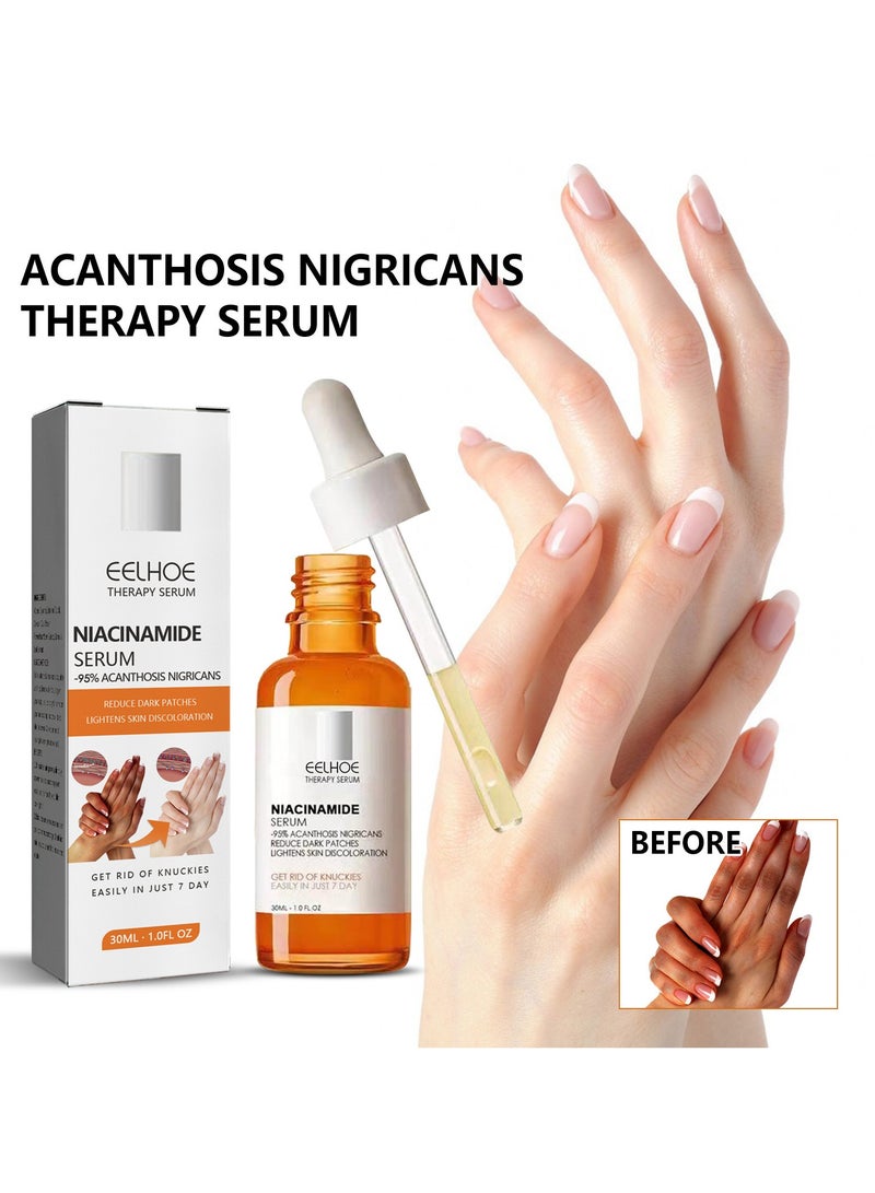 EELHOE مصل النياسيناميد، مصل علاج الشواك النيجيري، مصل تبييض المفاصل الداكنة، مصل النياسيناميد لإزالة الكوع المفصلي الداكن، تبييض تحت الإبط، تفتيح البشرة - Image 1