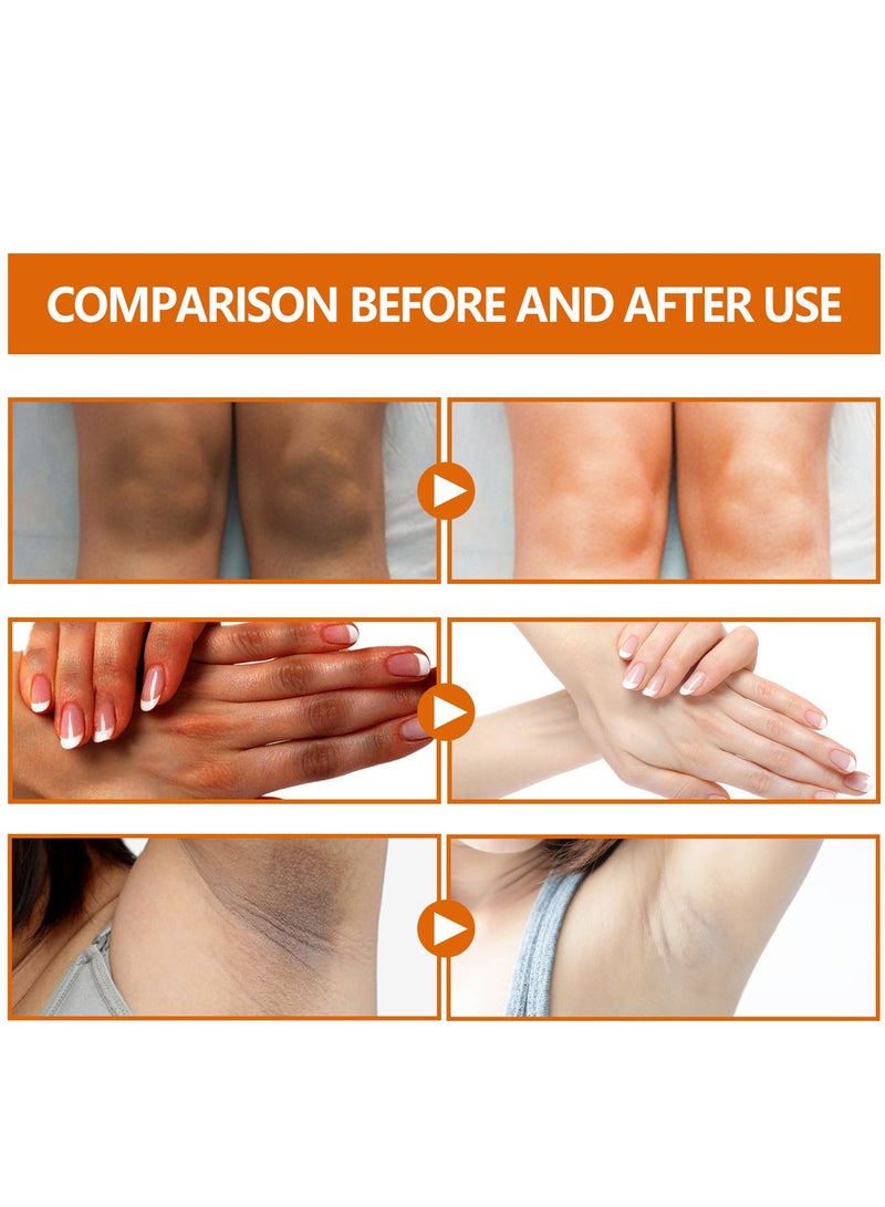 EELHOE مصل النياسيناميد، مصل علاج الشواك النيجيري، مصل تبييض المفاصل الداكنة، مصل النياسيناميد لإزالة الكوع المفصلي الداكن، تبييض تحت الإبط، تفتيح البشرة - Image 3