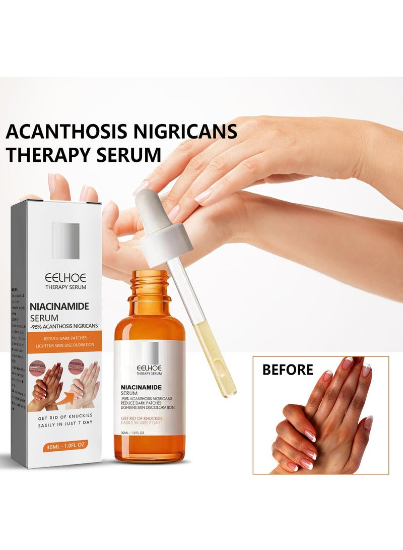 EELHOE مصل النياسيناميد، مصل علاج الشواك النيجيري، مصل تبييض المفاصل الداكنة، مصل النياسيناميد لإزالة الكوع المفصلي الداكن، تبييض تحت الإبط، تفتيح البشرة - Image 2