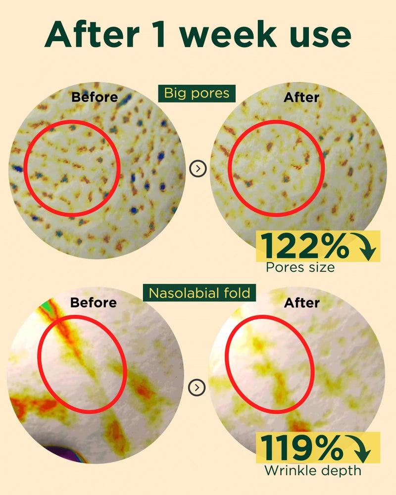 Easydew كريم EASYDEW DW-EGF ببتيد الريتينول 0.03% - كريم ليلي للريتينول للمبتدئين للعناية بالبشرة الحساسة - بشرة مشدودة، تحسين التجاعيد - علاج يومي كوري لمكافحة الشيخوخة للوجه والرقبة، 1.01 أونصة سائلة. - Image 4