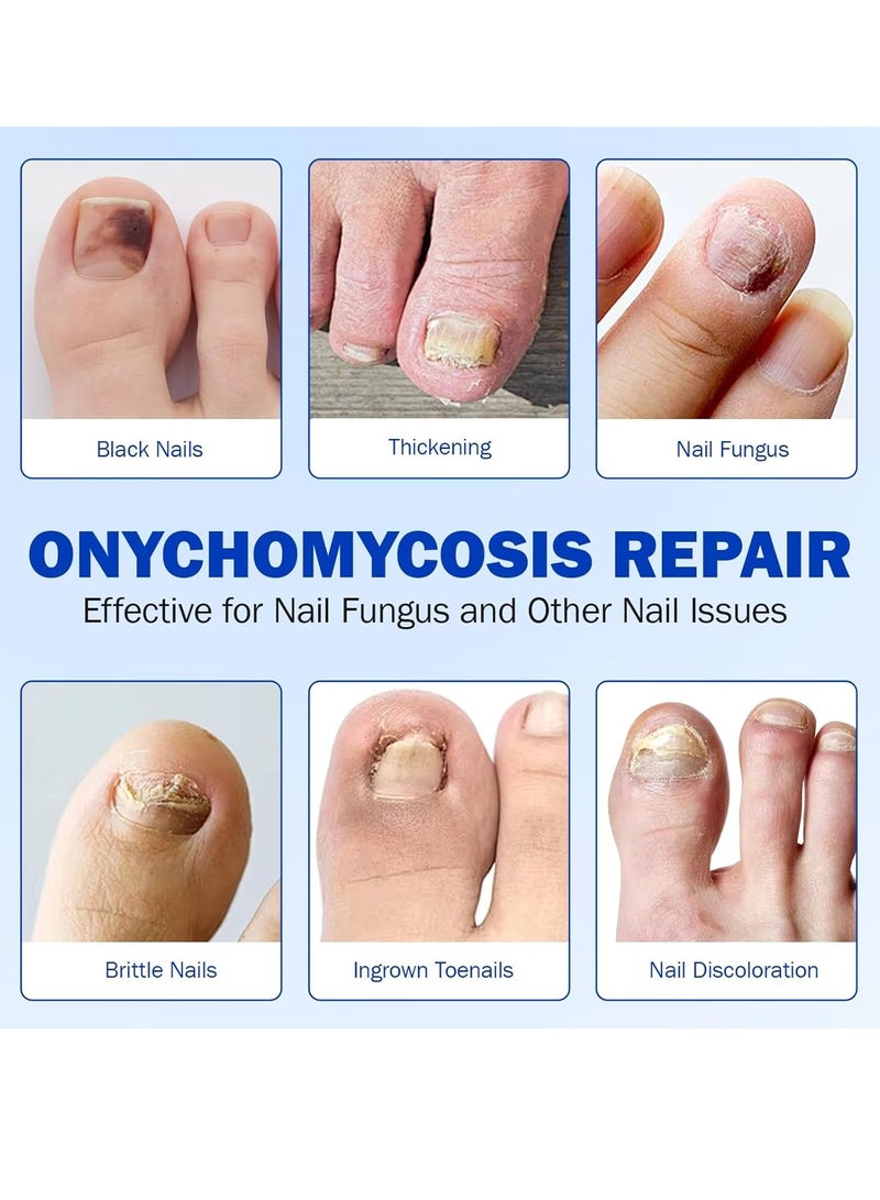 Elaimei 21Pcs Fungal Nail Patch Nail Treatment Renews Nails Structure and Improve Discoloration Overnight Nail Repair Patch for Nail Fungus Damage 8Hrs Nighttime Renewal Fungal Nail Patches - Image 2
