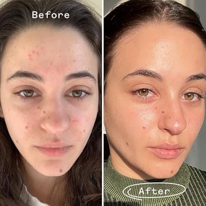 Pai Skincare - Organic Carbon Star Detoxifying Overnight Face Oil | Natural, Vegan, Sensitive Skincare (Travel, 0.34 fl oz | 10 ml) - Image 5