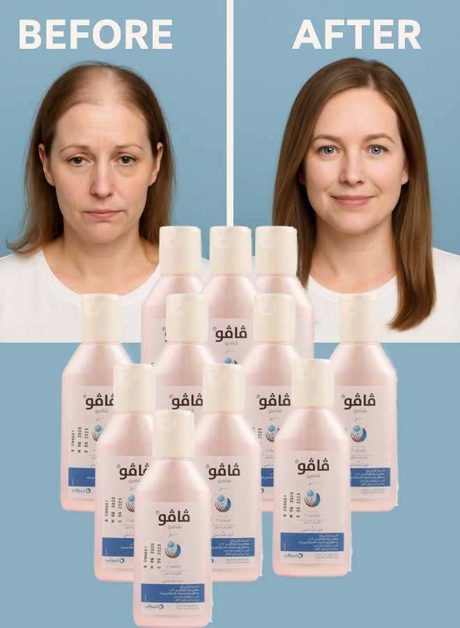 فافو 11 قطع فافو 2% شامبو 100مل - Image 1