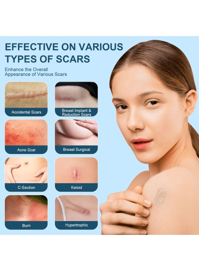 MJZ 50ml Scar Cream, Silicone Scar Gel, Treats Old and New Scars, Scar Removal Cream, Scar Treatment, Reduces the Appearance of Scars from, Body, Face, Stretch Marks, Surgical Scar, Keloids, Acne, Burns and More - Image 4