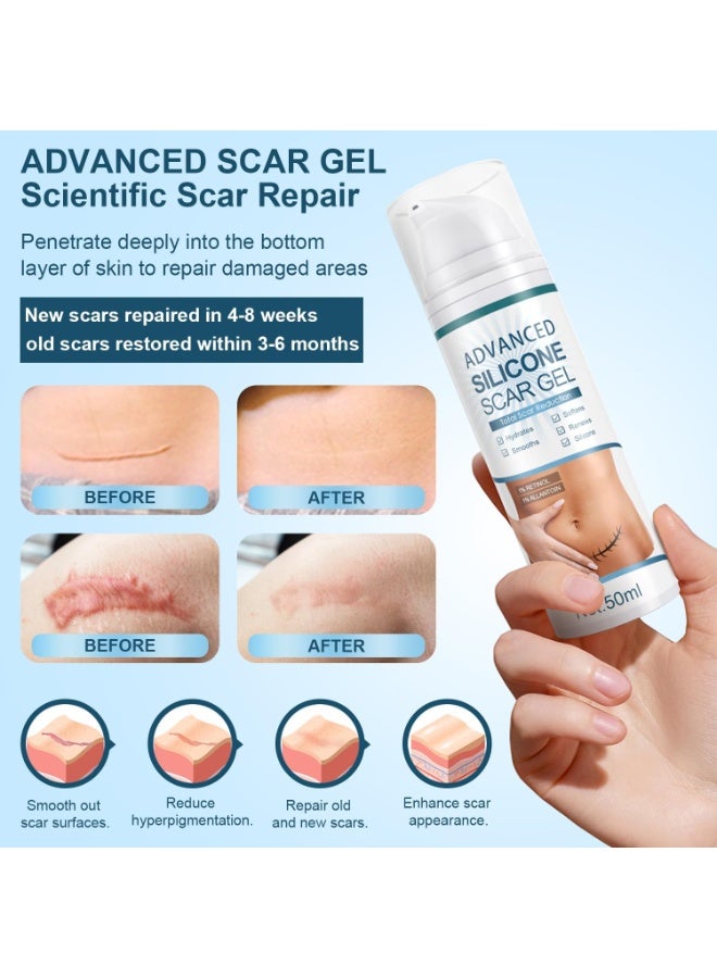 MJZ 50ml Scar Cream, Silicone Scar Gel, Treats Old and New Scars, Scar Removal Cream, Scar Treatment, Reduces the Appearance of Scars from, Body, Face, Stretch Marks, Surgical Scar, Keloids, Acne, Burns and More - Image 3