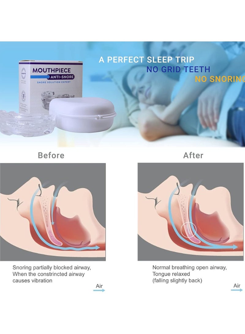 Adjustable Anti Snoring Devices, Anti Snore Mouth Guard, Anti Snoring Mouthpiece, Snoring Solutions Comfortable Snoring Aids for Men Women, Reusable Anti Snore Devices - Image 3