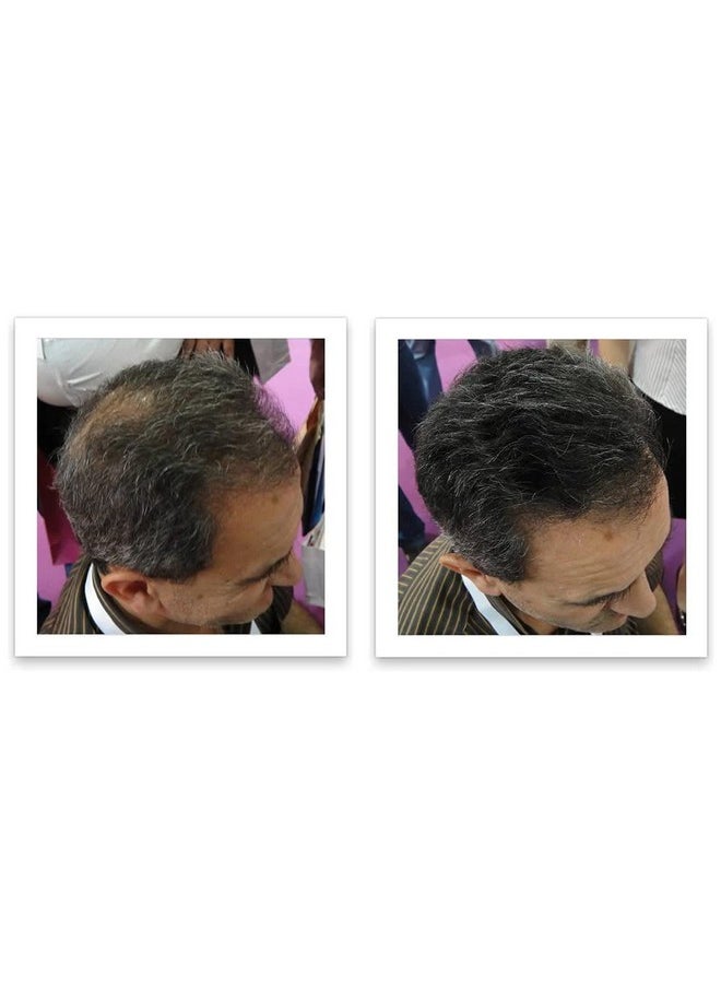 Caboki - Hair Loss Concealer. All-Natural Hair Building Fiber. Make Thin Hair Look 10X Fuller Instantly. Eliminate The Appearance Of Bald Spot And Thinning Hair (30G, 90-Day Supply). Salt & Pepper-Dark - Image 1