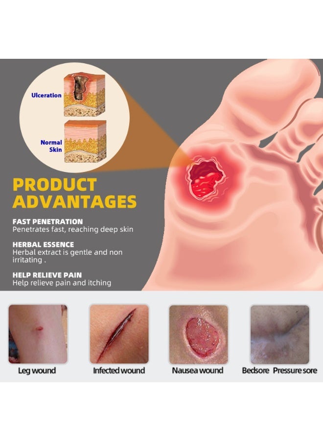 سوميفون مرهم لقرحة الفراش، مرهم للعناية طويلة الأمد بقرحة الفراش، مرهم مضاد للبكتيريا للجسم، 20*2 غرام - Image 4
