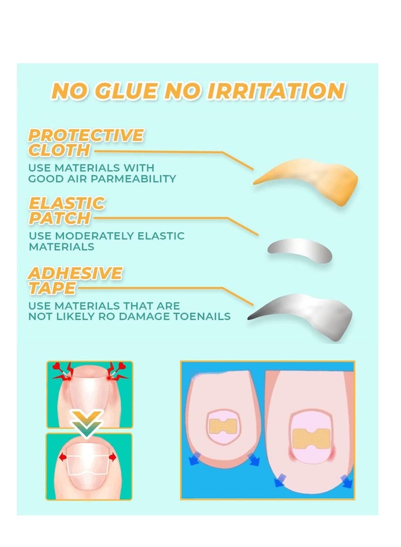 100 قطعة من ملصقات تصحيح الأظافر ، ملصقات تصحيح الأظافر المغروسة، شرائط تصحيح الأظافر الخالية من الغراء، علاج فعال لتصحيح الأظافر بدون ألم، يساعد في تخفيف أخاديد الظفر. - Image 2