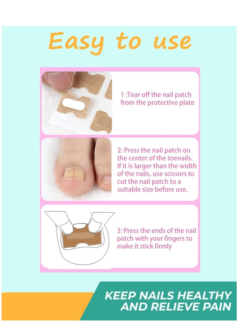 100 قطعة من ملصقات تصحيح الأظافر ، ملصقات تصحيح الأظافر المغروسة، شرائط تصحيح الأظافر الخالية من الغراء، علاج فعال لتصحيح الأظافر بدون ألم، يساعد في تخفيف أخاديد الظفر. - Image 5