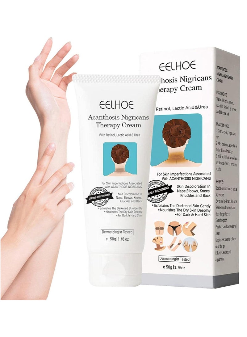 EELHOE Acanthosis Nigricans Therapy Cream - Reduces Dark Elbows - Acanthosis Nigricans Therapy Oil - Acanthosis Nigricans Treatment (1 pc) - Image 2