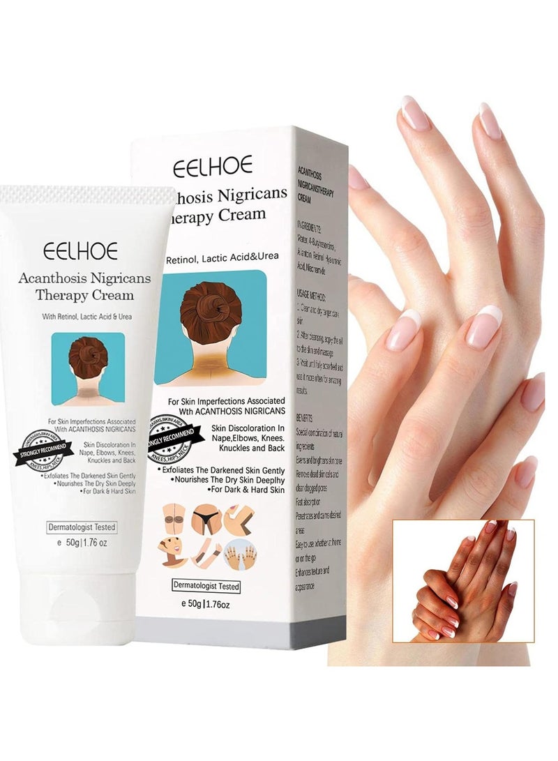 EELHOE Acanthosis Nigricans Therapy Cream - Reduces Dark Elbows - Acanthosis Nigricans Therapy Oil - Acanthosis Nigricans Treatment (1 pc) - Image 1