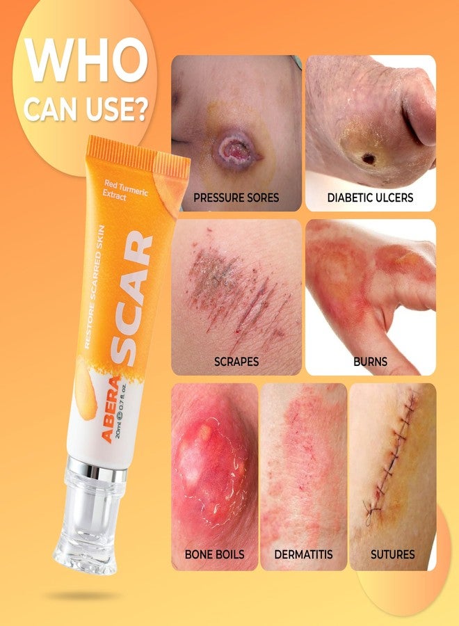 ABERA | Scar Red Turmeric Cream - Advanced Scar Treatment for Face and Body, Rapid Removal of Any Type of Scars with Natural Ingredients - with Gold Eye Patch (2 Box + 5 Eye Patch.) - Image 2