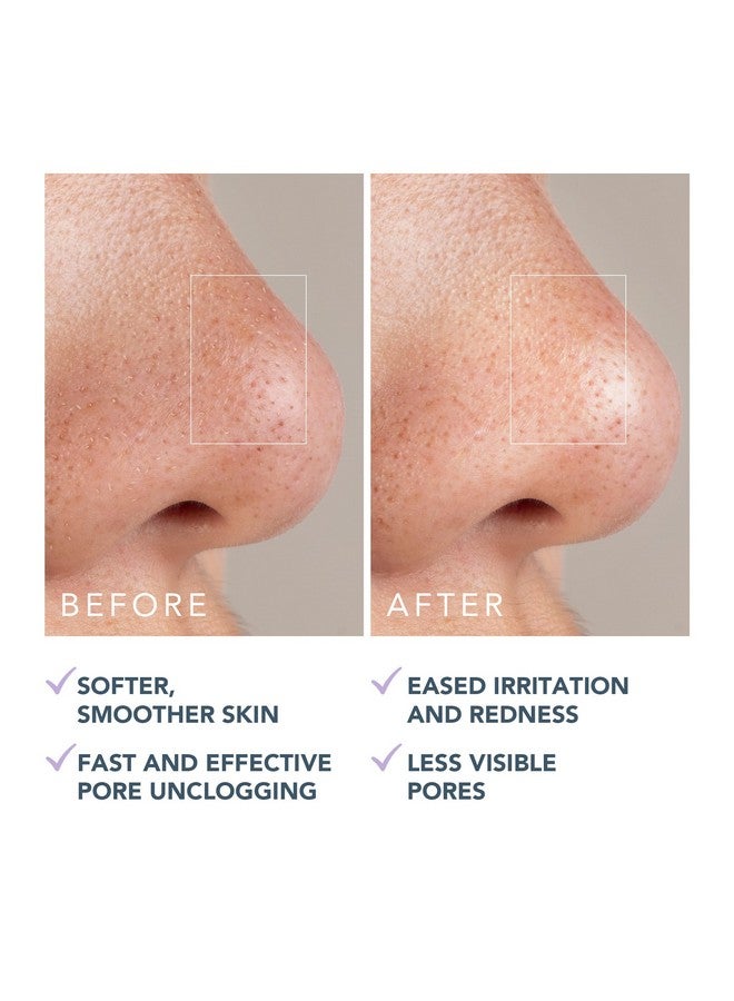 فوريو قناع فوريو كيوي النشط للمسام والرؤوس السوداء، 3.5 أونصة - مزيل للرؤوس السوداء - قناع طيني وزيت الجوجوبا المرطب - مُقلل للمسام - قناع لتنقية البشرة وإزالة السموم من الوجه - نباتي وخالٍ من القسوة - لجميع أنواع البشرة - Image 5