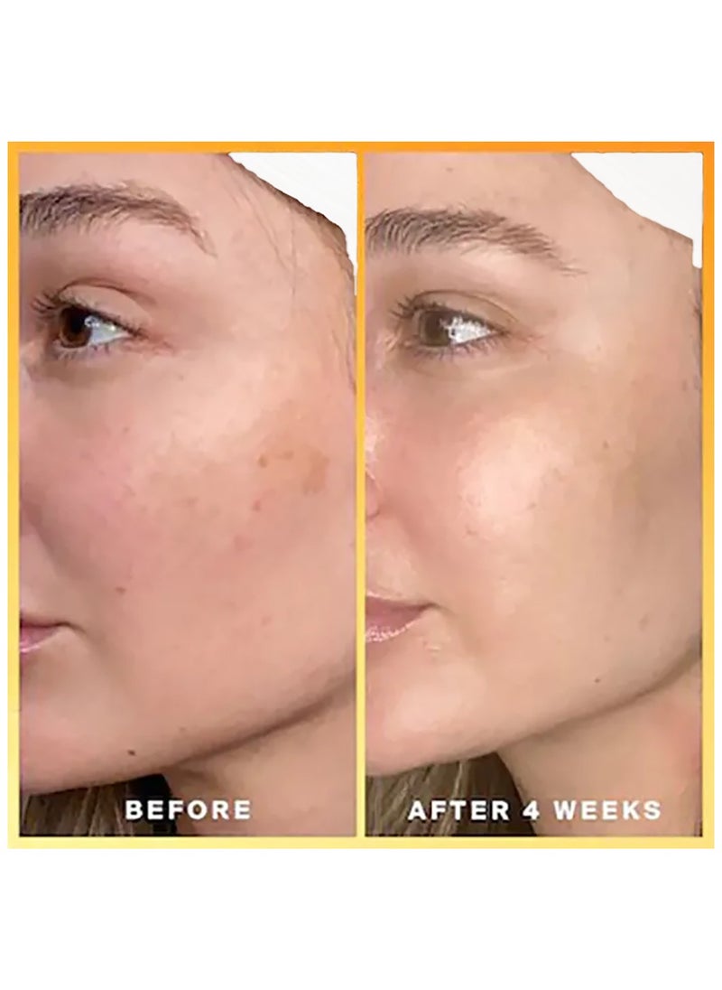 Advent Pure Kojic Acid Powder - Skin Brightening Formula  - Image 3