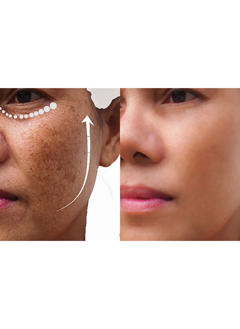 Advent Pure Kojic Acid Powder - Skin Brightening Formula  - Image 5
