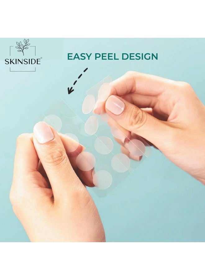 Skinside - Acne Pimple Patches For Face Pimples (72 Patches) Hydrocolloid Facial Patches With 0.5% Salicylic Acid For Pimple Healing | Invisible Waterproof Absorbs Excess Oil Overnight (72 Patches) - Image 1