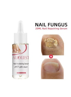 Nail strengthening serum 20ml - pzsku/Z0B212678AAA75A5C70A7Z/45/_/1715883681/650adf4d-a56e-4244-8dab-d19a47d54c86