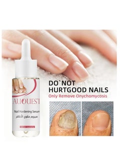 Nail strengthening serum 20ml - pzsku/Z0B212678AAA75A5C70A7Z/45/_/1715883692/2b42c9c2-e57a-4b95-abad-7839a03af696