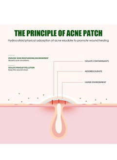 Generic Acne Patch (24 Count) Hydrocolloid Acne Cover Patches  - Image 5