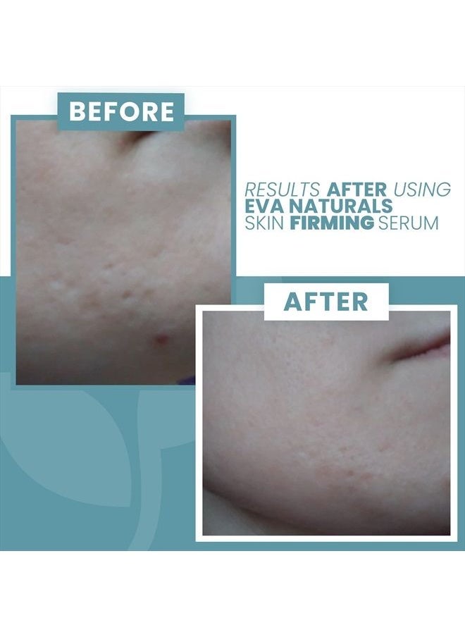 Eva Naturals - Skin Firming Serum - Niacinamide Serum for Face with Vitamin C and Hyaluronic Acid - Acne Serum for Face - Face Serum for Sensitive Skin and Acne - Skin Clearing Serum - Skin Serum for Firm Skin & Wri - Image 1