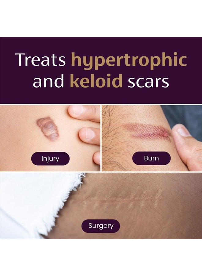 Mederma Medical Grade Silicone Scar Sheets; Improves The Appearance of Old and New Scars; for Injury, Burn and Surgery Scars, 4 Count - Image 3