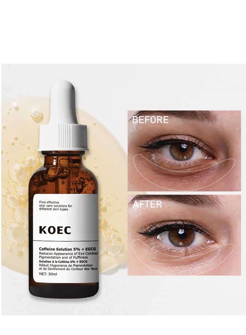 ك أو إي سي مصل إزالة الهالات السوداء محلول الكافيين 5% + EGCG يقلل من ظهور تصبغ محيط العين والانتفاخاتمحلول الكافيين 5% + EGCG يقلل من ظهور تصبغ محيط العين والانتفاخات 30 مل - Image 1
