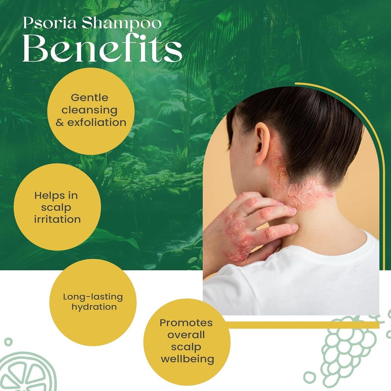SiyaAyurveda مجموعة Siya Ayurveda للعناية بالجسم والشعر لمرض الصدفية 3  غسول الجسم لتهدئة البشرة بشكل طبيعي  شامبو للصدفية  كريمات ترطيب الجسم للرجال والنساء - Image 5
