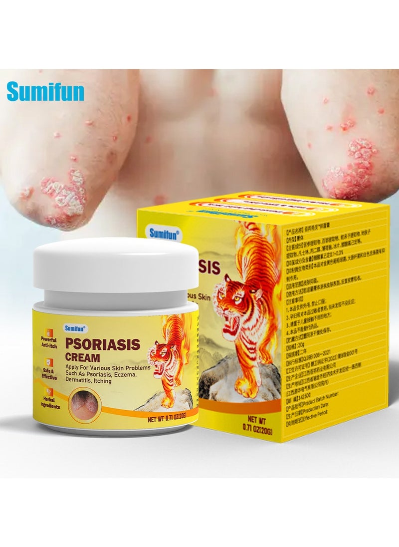 Suitable For Various Skin Conditions Such As Psoriasis, Eczema, Dermatitis, And Itching. 20g