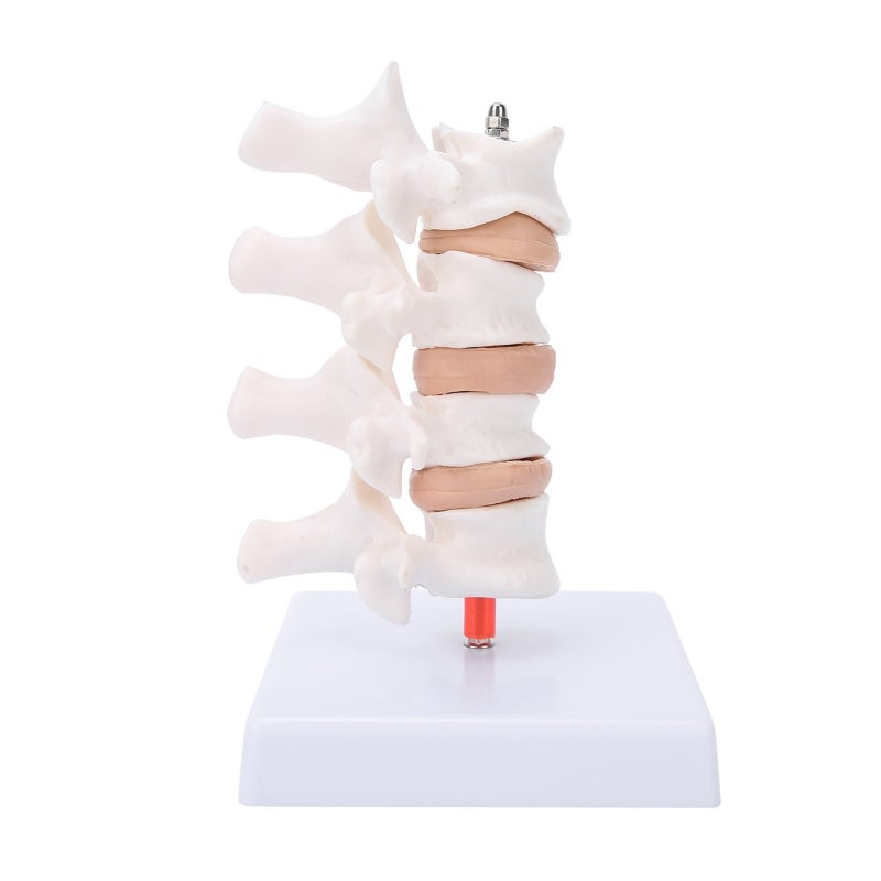 Human Anatomical Spine Model: High-Quality PVC Material, Durable - Pathological Changes Demonstration Professional Osteoporosis Model for Medical Teaching, Doctor-Patient Explanation - Image 4