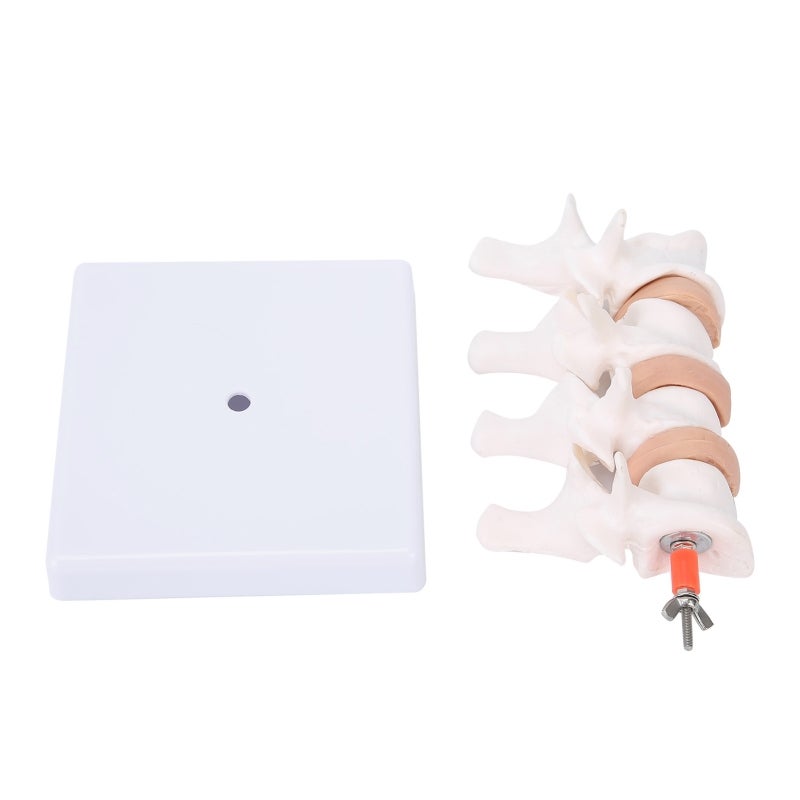 Human Anatomical Spine Model: High-Quality PVC Material, Durable - Pathological Changes Demonstration Professional Osteoporosis Model for Medical Teaching, Doctor-Patient Explanation - Image 5