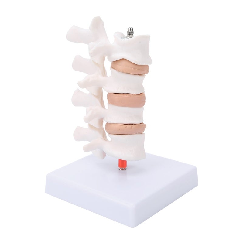 Human Anatomical Spine Model: High-Quality PVC Material, Durable - Pathological Changes Demonstration Professional Osteoporosis Model for Medical Teaching, Doctor-Patient Explanation - Image 2