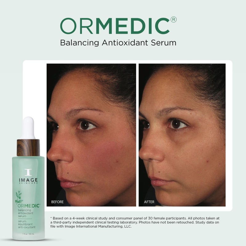 IMAGE Skincare, ORMEDIC Balancing Antioxidant Serum, Hydrates & Soothes Skin with Organic Aloe Vera, Vitamin C, & Botanical Extracts, 1 fl oz - Image 3