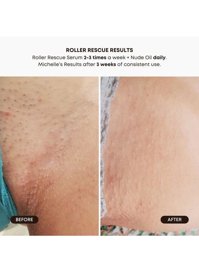 Bushbalm روتين الشعر الناشئ - مجموعة إنقاذ الرولر، زيت نود و مقشر نود - AHA & BHA - مقشر، مهدئ، مبرّد للمناطق الحساسة، تحت الإبطين - يساعد في تقليل نتوءات الحلاقة، مجموعة نهائية (ثلاثية)  - Image 4