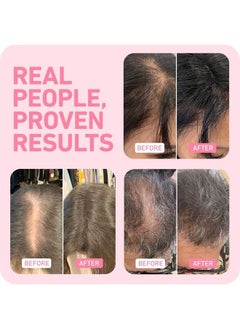 Boldify BOLDIFY Hair Fibers for Thinning Hair (BLACK) Undetectable - 56gr Bottle - Completely Conceals Hair Loss in 15 Sec - Hair Thickener for Fine Hair for Women & Men  - Image 5