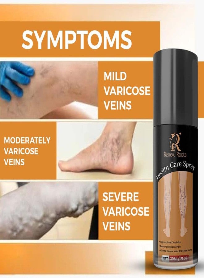 Renew Roots NATURAL HERBAL Varicose Pain Relief Oil 30ml | Fast Action Formula for Leg, Nerve & Vein Pain | Helps Reduce Swelling, Burning & Discomfort | Improves Circulation - Image 2
