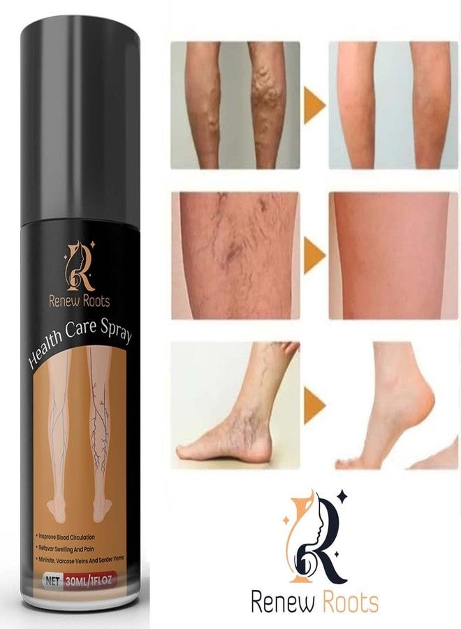 Renew Roots NATURAL HERBAL Varicose Pain Relief Oil 30ml | Fast Action Formula for Leg, Nerve & Vein Pain | Helps Reduce Swelling, Burning & Discomfort | Improves Circulation - Image 3