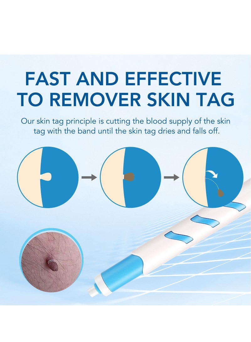 Sefudun Small Head Wart Removal Tool Skin Tag Removal  - Image 3