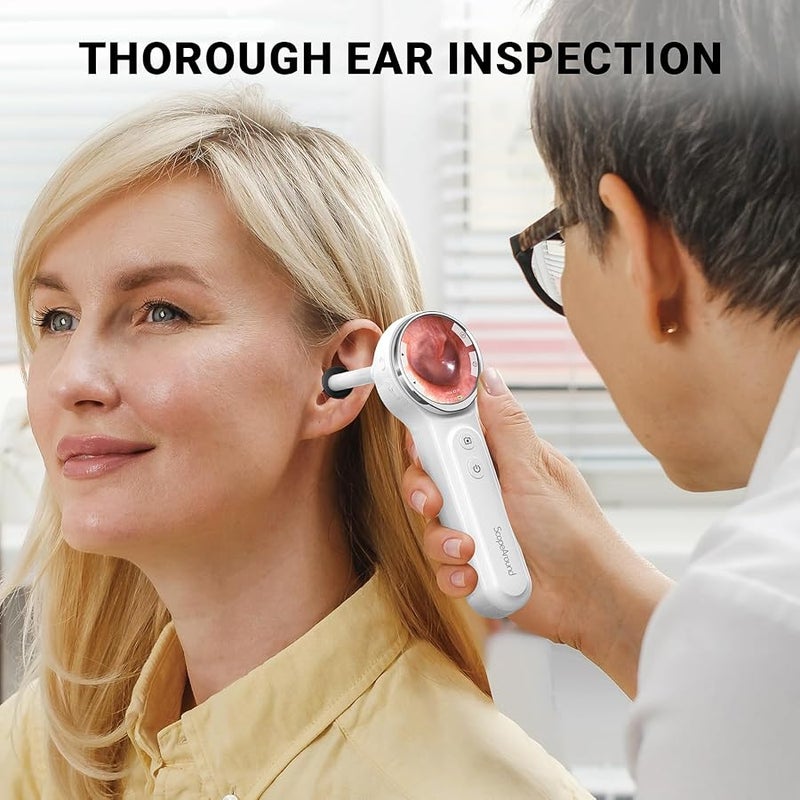ScopeAround Otoscope, 720PHD Ear Scope Set, Digital Otoscope w/1.85in IPS Screen, Ear Wax Removal Tool Camera, Video Otoscope Ear Camera with 6 LED Lights, Compatible with Android/iPhone - Image 2