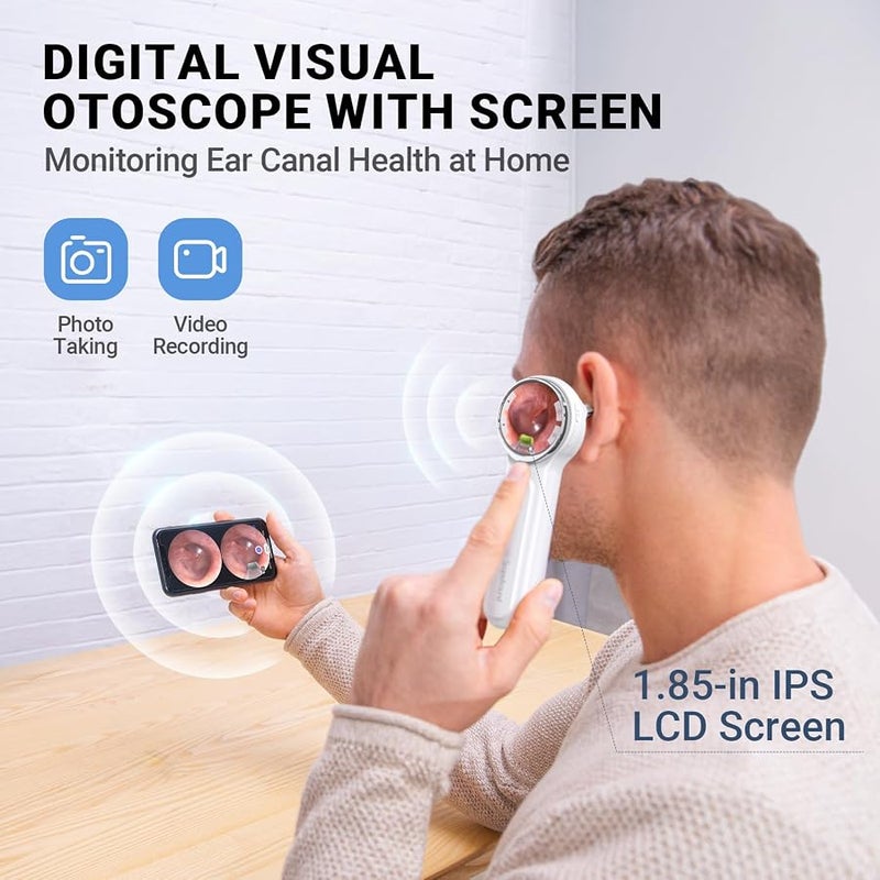ScopeAround Otoscope, 720PHD Ear Scope Set, Digital Otoscope w/1.85in IPS Screen, Ear Wax Removal Tool Camera, Video Otoscope Ear Camera with 6 LED Lights, Compatible with Android/iPhone - Image 5