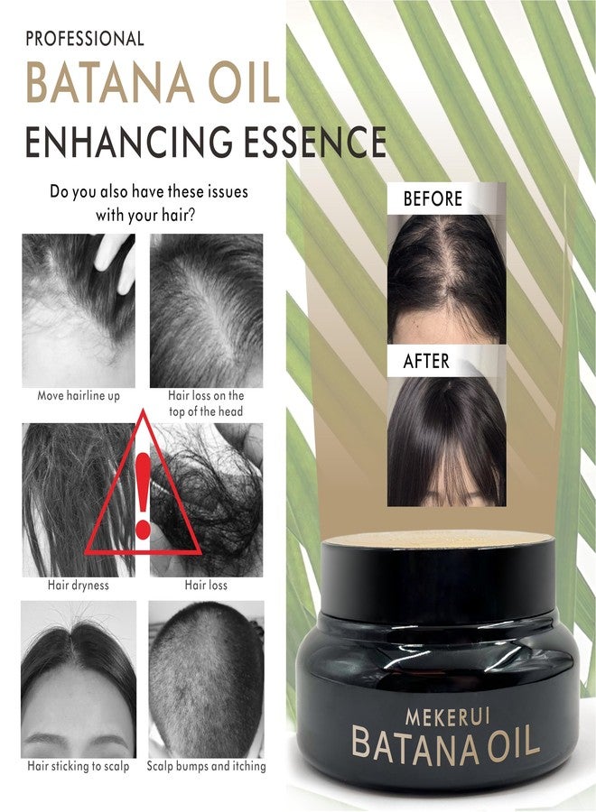 MEKERUI Batana Oil for Hair Growth 100% Pure | Traditional Cold-Pressed Method from Honduras | Scalp Treatment to Thicken Hair, Reduce Breakage & Frizz | 160g (5.6oz) for Men & Women - Image 4