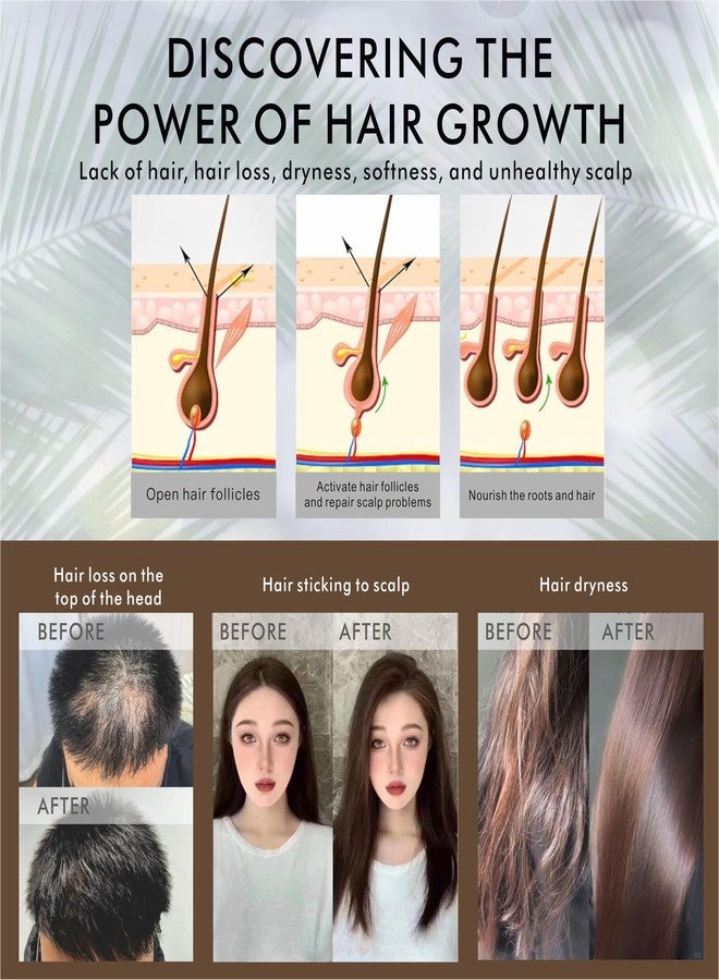 MEKERUI Batana Oil for Hair Growth 100% Pure | Traditional Cold-Pressed Method from Honduras | Scalp Treatment to Thicken Hair, Reduce Breakage & Frizz | 160g (5.6oz) for Men & Women - Image 5