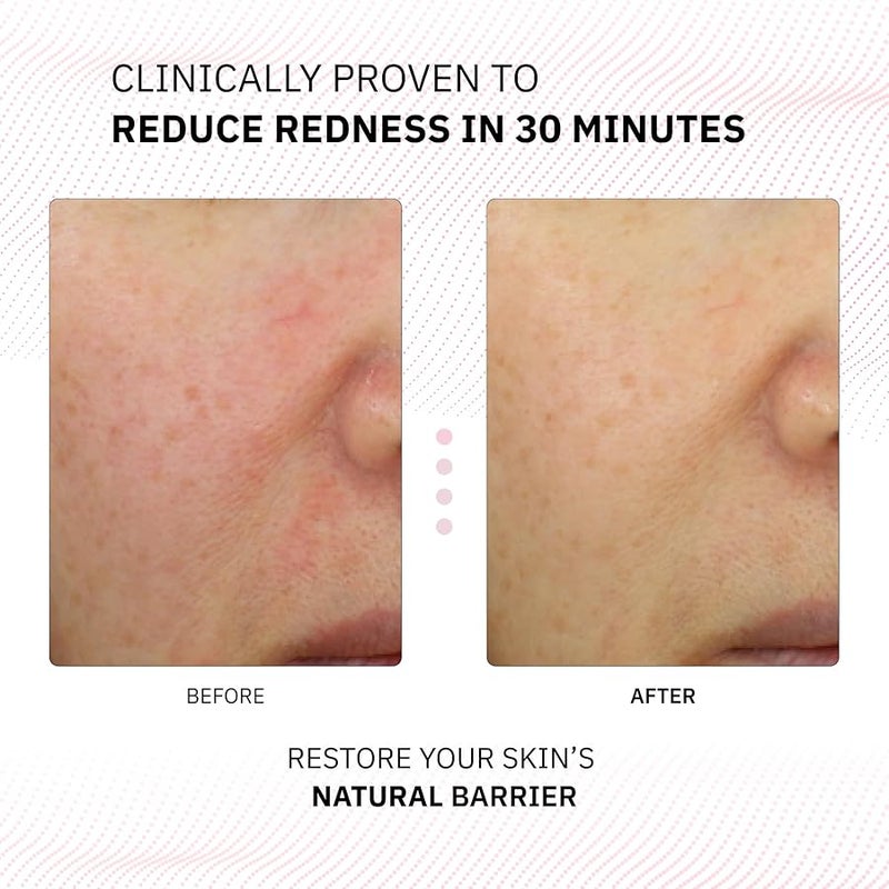Physiogel Calming Relief Face and Body Lotion Reduces Redness in just 3 days Moisturizer for Dry Red Itchy Sensitive Skin Korean skin care FragranceFree NonComedogenic DermatologistTested - Image 2