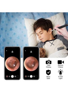 General Earwax remover suction, otoscope with endoscopic camera, electric ear cleaner, WiFi ear cleaner, 8 million pixels, IPX5 waterproof for kids  - Image 2