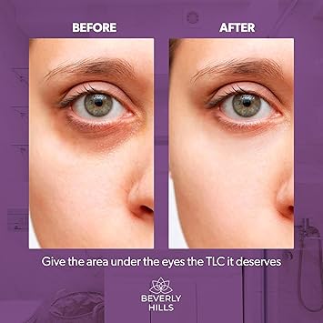 Beverly Hills Eye Cream for Dark Circles and Puffy Eyes AntiAging Eye Care Reduces Dark Circles Puffiness 30ml - Image 4