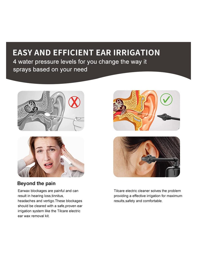 SYOSI Ear Wax Removal Kit, Water Powered Ear Cleaner with 3 Pressure Modes, Ear Irrigation Flushing System  Waterproof Electric Ear Cleaning Tool for Adults & Kids with Basin & 6 Tips(Black) - Image 2